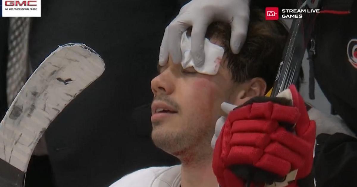 Tom Wilson-Hit-Logan Stankoven-