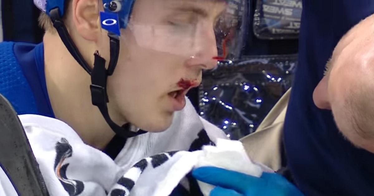 Jesper Fast is busted open after face planting on to the ice.