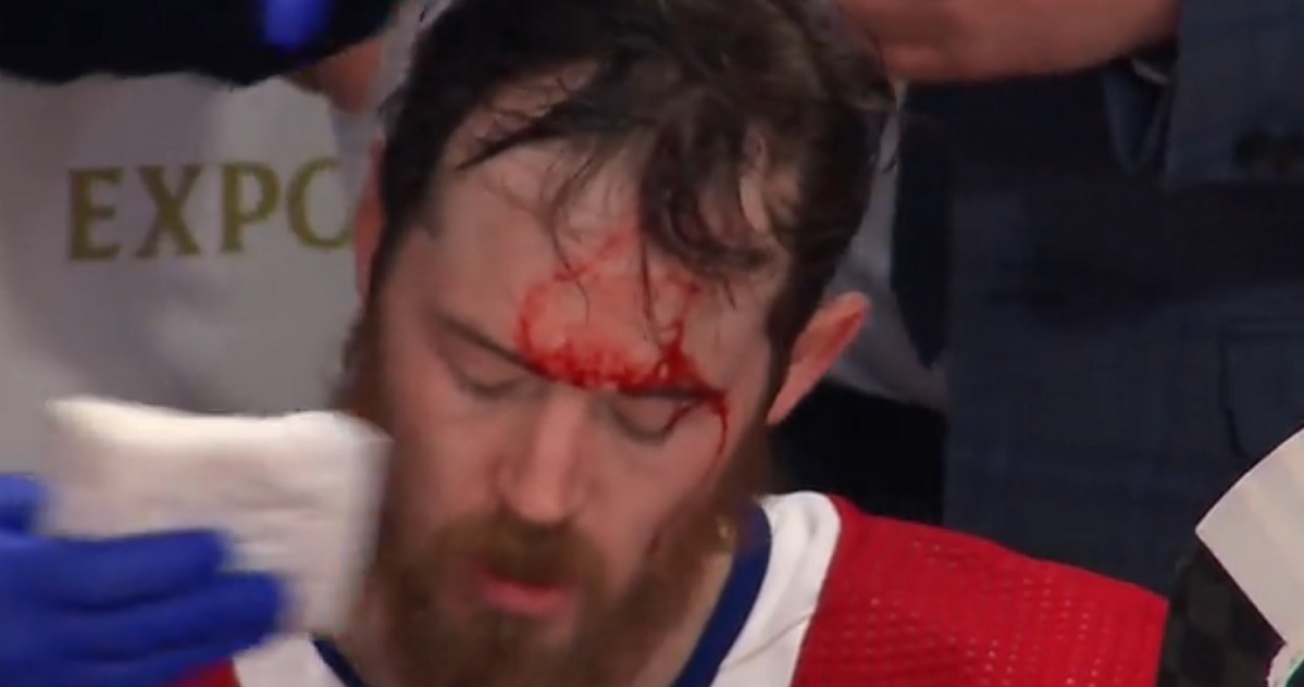 Paul Byron busted open after losing his helmet.