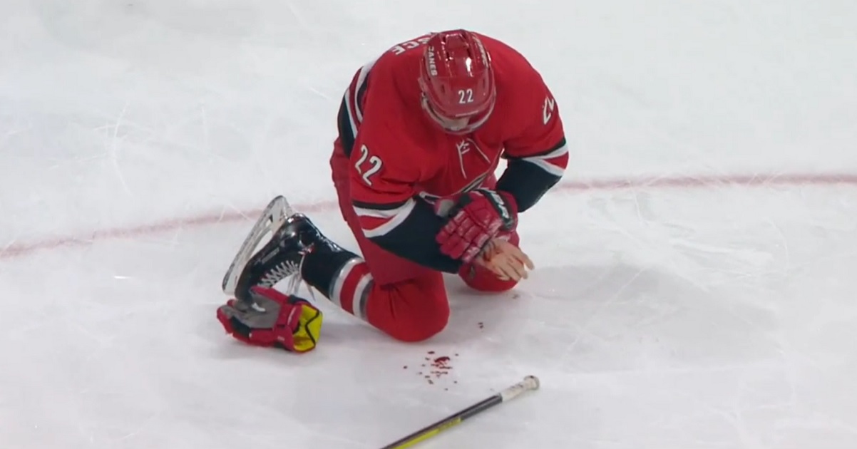 Brett Pesce left bleeding all over the ice after blocking a shot.