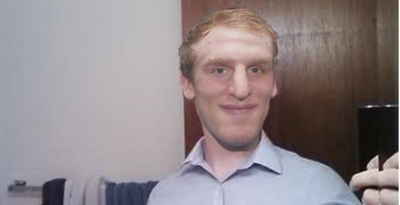 (Photos): Fan undergoes 13 surgeries, spends 150K to look like his favourite player!