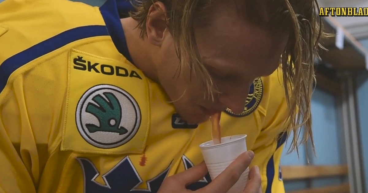 Brutal video shows NHL defenseman spitting out his teeth in the locker room.
