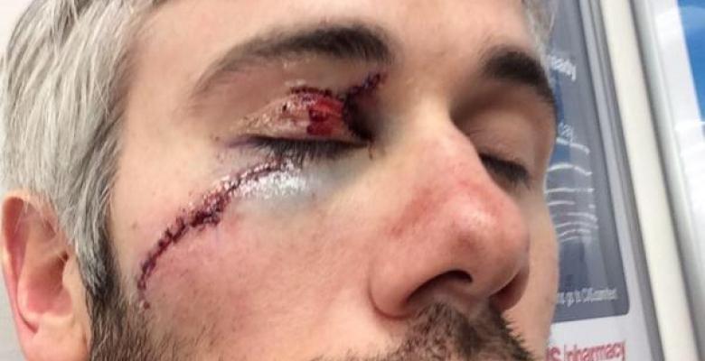 Breaking: First look at the gruesome injury to Drew Miller's face.