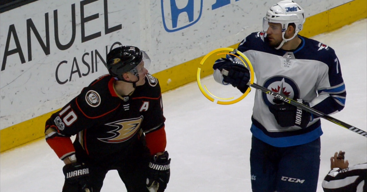 Corey Perry bloodied after taking a butt-end to the face.